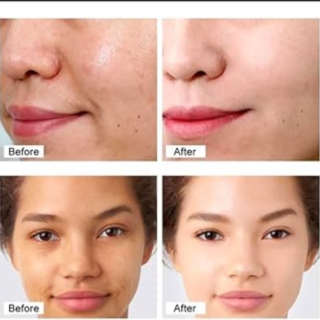 Chalonese Brightening Cream | (For both Men & Women)
