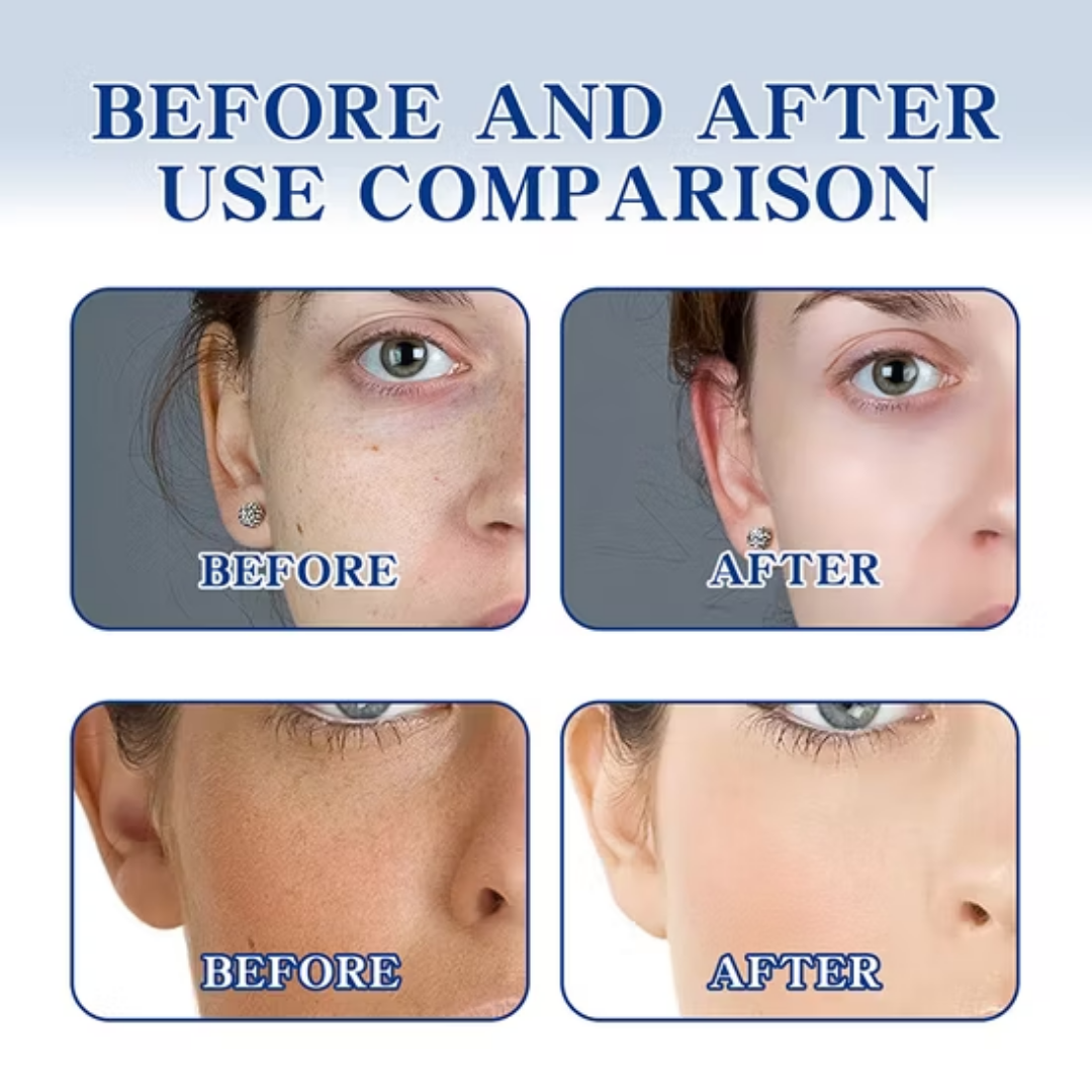 Chalonese Brightening Cream | (For both Men & Women)